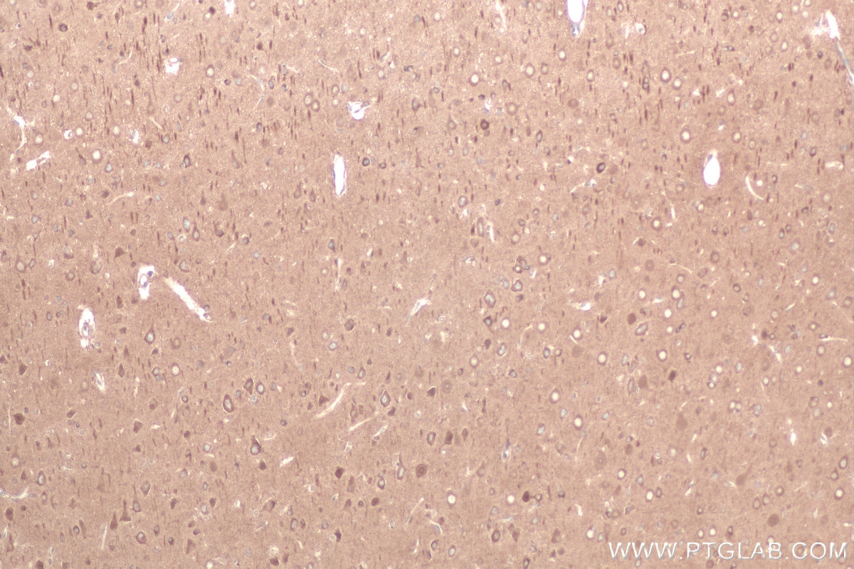 Immunohistochemical analysis of paraffin-embedded rat brain tissue slide using KHC0879 (GARS IHC Kit).