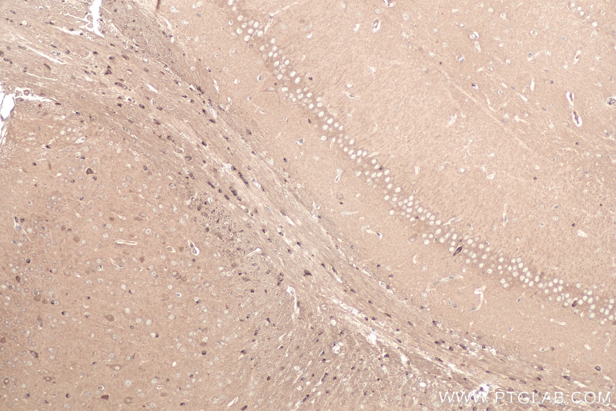 Immunohistochemical analysis of paraffin-embedded mouse brain tissue slide using KHC0879 (GARS IHC Kit).