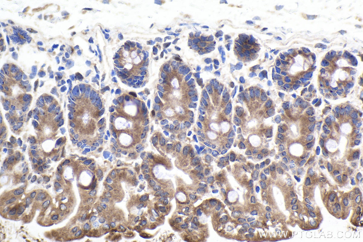 Immunohistochemical analysis of paraffin-embedded mouse small intestine tissue slide using KHC1921 (GBP3 IHC Kit).