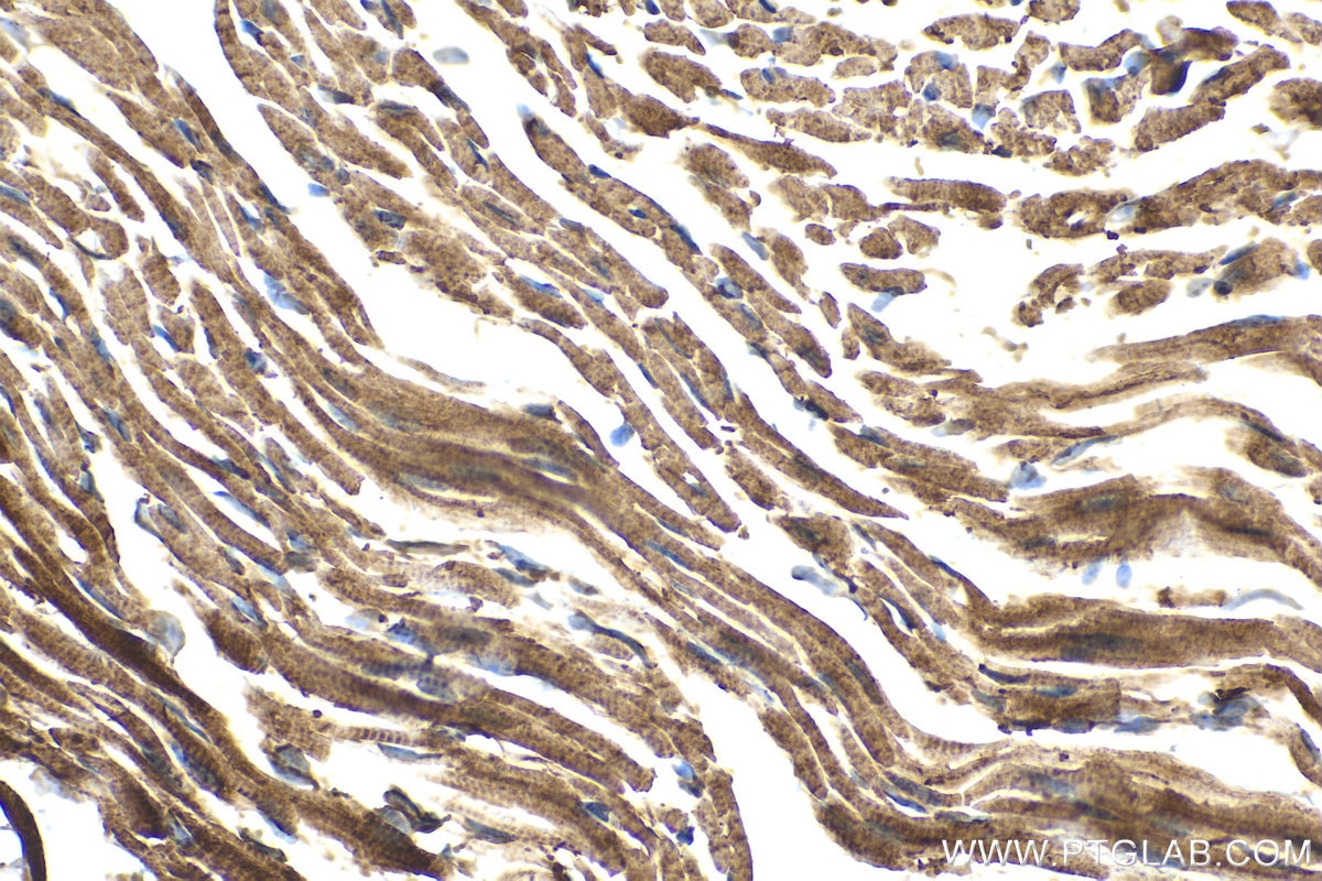 Immunohistochemical analysis of paraffin-embedded mouse heart tissue slide using KHC1584 (GCK IHC Kit).