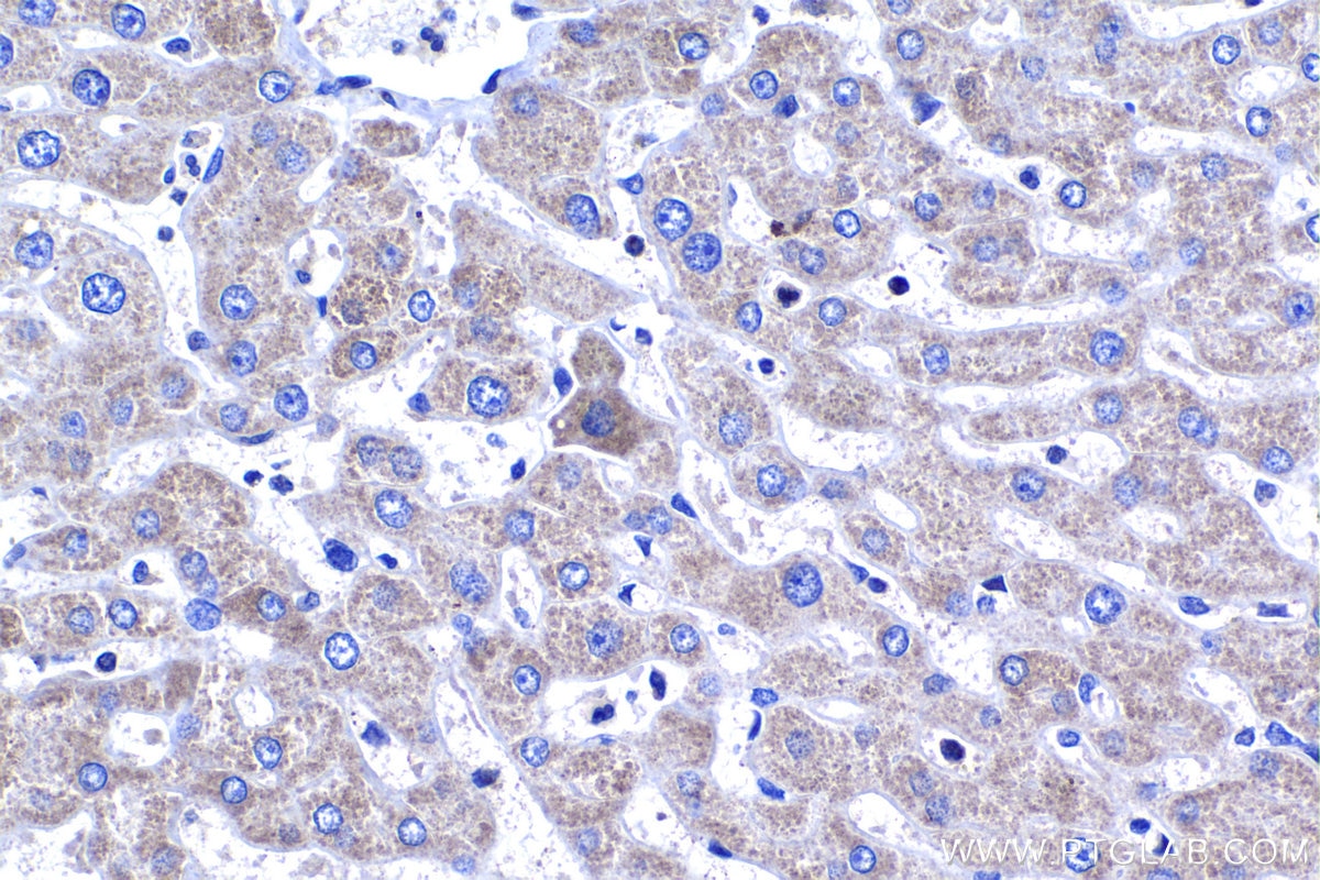 Immunohistochemical analysis of paraffin-embedded human liver tissue slide using KHC1389 (GCNT2 IHC Kit).