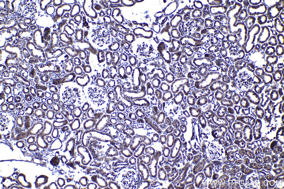 Immunohistochemical analysis of paraffin-embedded rat kidney tissue slide using KHC1389 (GCNT2 IHC Kit).