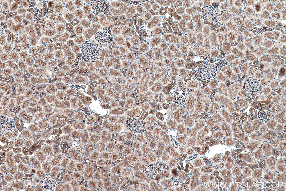 Immunohistochemical analysis of paraffin-embedded rat kidney tissue slide using KHC0691 (GDI2 IHC Kit).