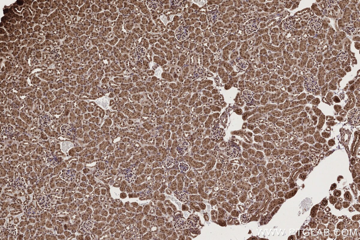 Immunohistochemical analysis of paraffin-embedded mouse kidney tissue slide using KHC2725 (GEMIN5 IHC Kit).