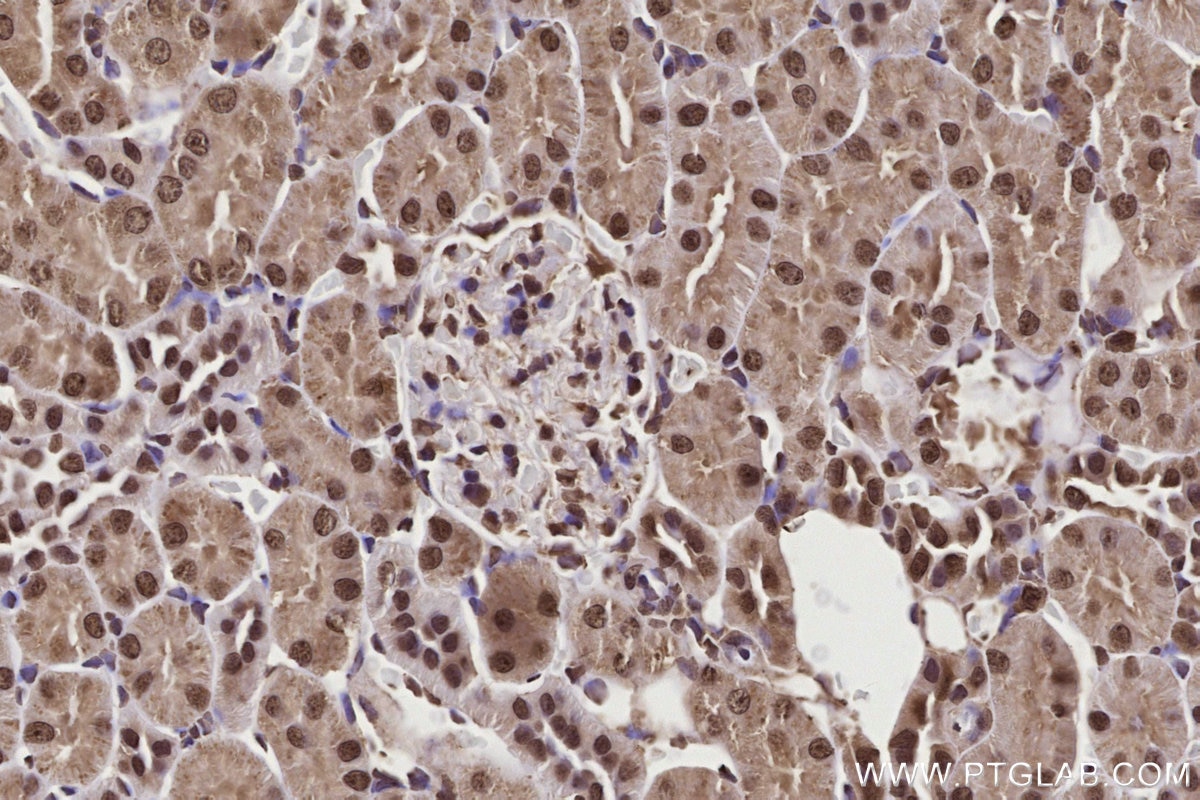 Immunohistochemical analysis of paraffin-embedded rat kidney tissue slide using KHC2725 (GEMIN5 IHC Kit).