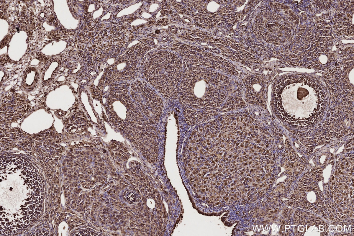 Immunohistochemical analysis of paraffin-embedded rat ovary tissue slide using KHC2725 (GEMIN5 IHC Kit).