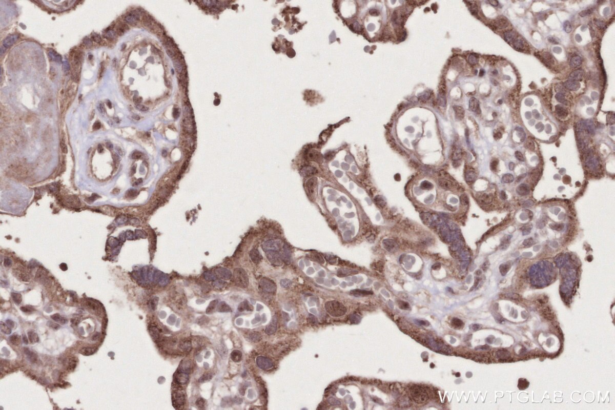 Immunohistochemical analysis of paraffin-embedded human placenta tissue slide using KHC2739 (GEMIN6 IHC Kit).