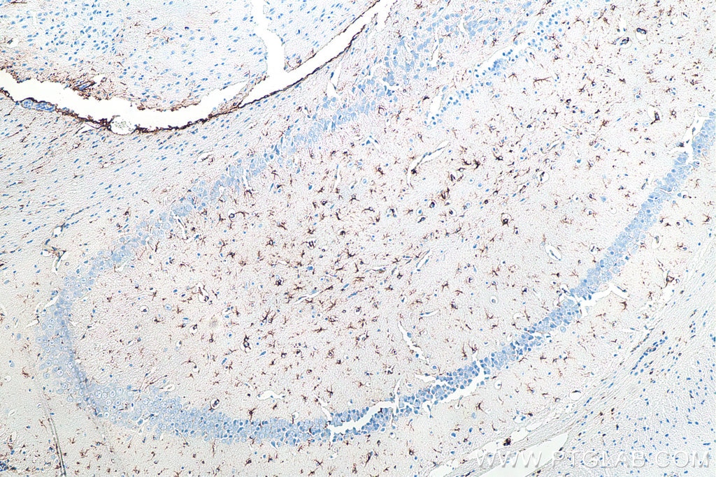 Immunohistochemical analysis of paraffin-embedded mouse brain tissue slide using KHC0002 (GFAP IHC Kit).