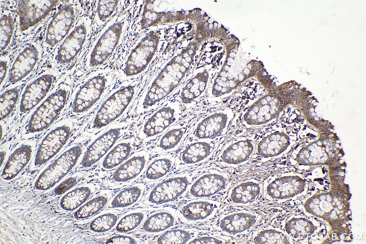 Immunohistochemical analysis of paraffin-embedded human colon tissue slide using KHC0998 (GGH IHC Kit).