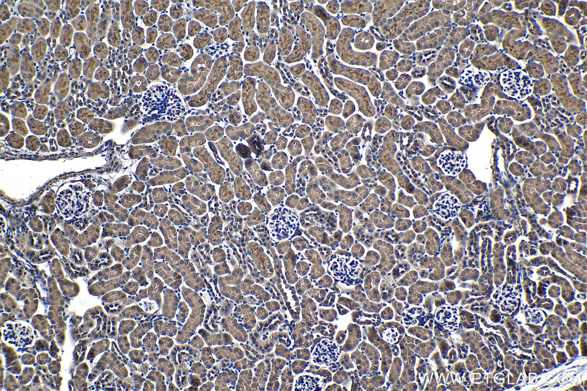 Immunohistochemical analysis of paraffin-embedded mouse kidney tissue slide using KHC1279 (GHDC IHC Kit).