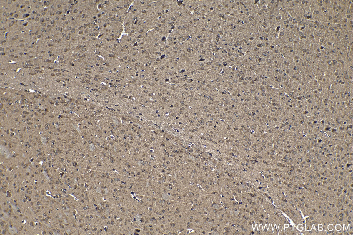 Immunohistochemical analysis of paraffin-embedded mouse brain tissue slide using KHC1279 (GHDC IHC Kit).