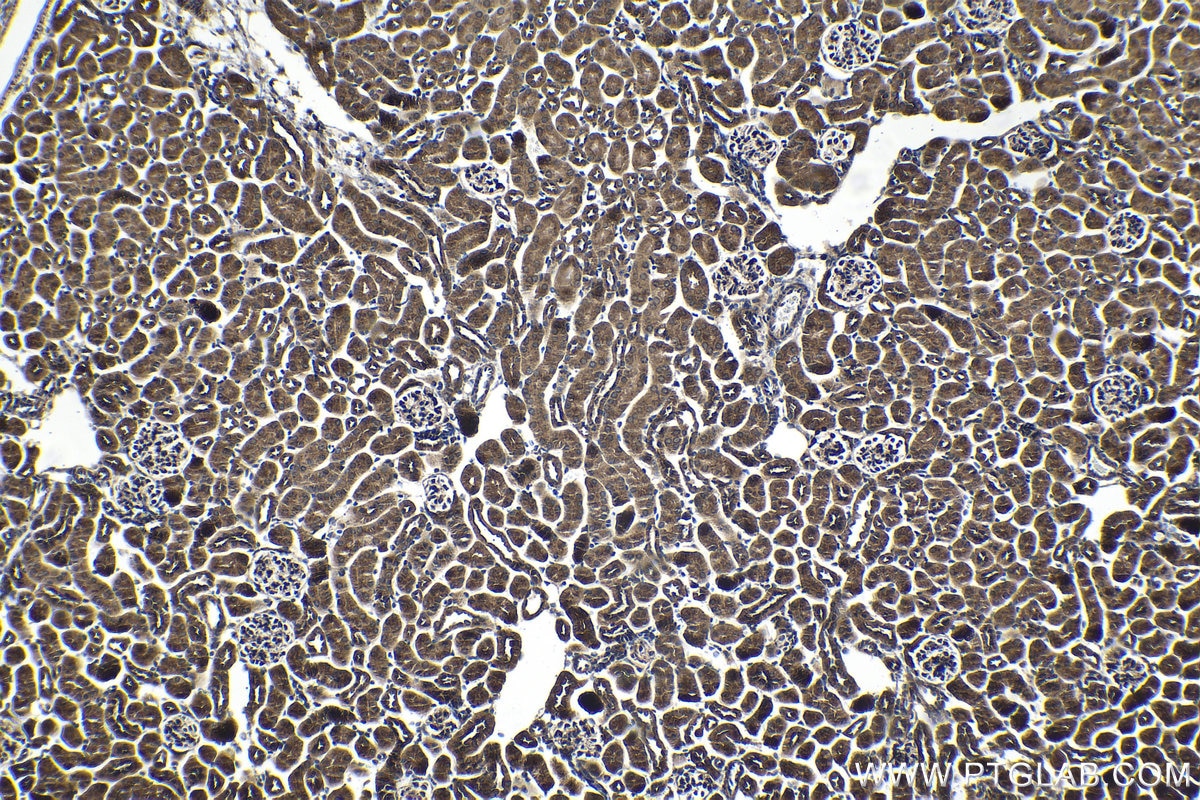 Immunohistochemical analysis of paraffin-embedded mouse kidney tissue slide using KHC1379 (GLI2 IHC Kit).