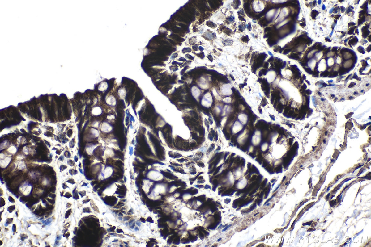 Immunohistochemical analysis of paraffin-embedded rat colon tissue slide using KHC1379 (GLI2 IHC Kit).