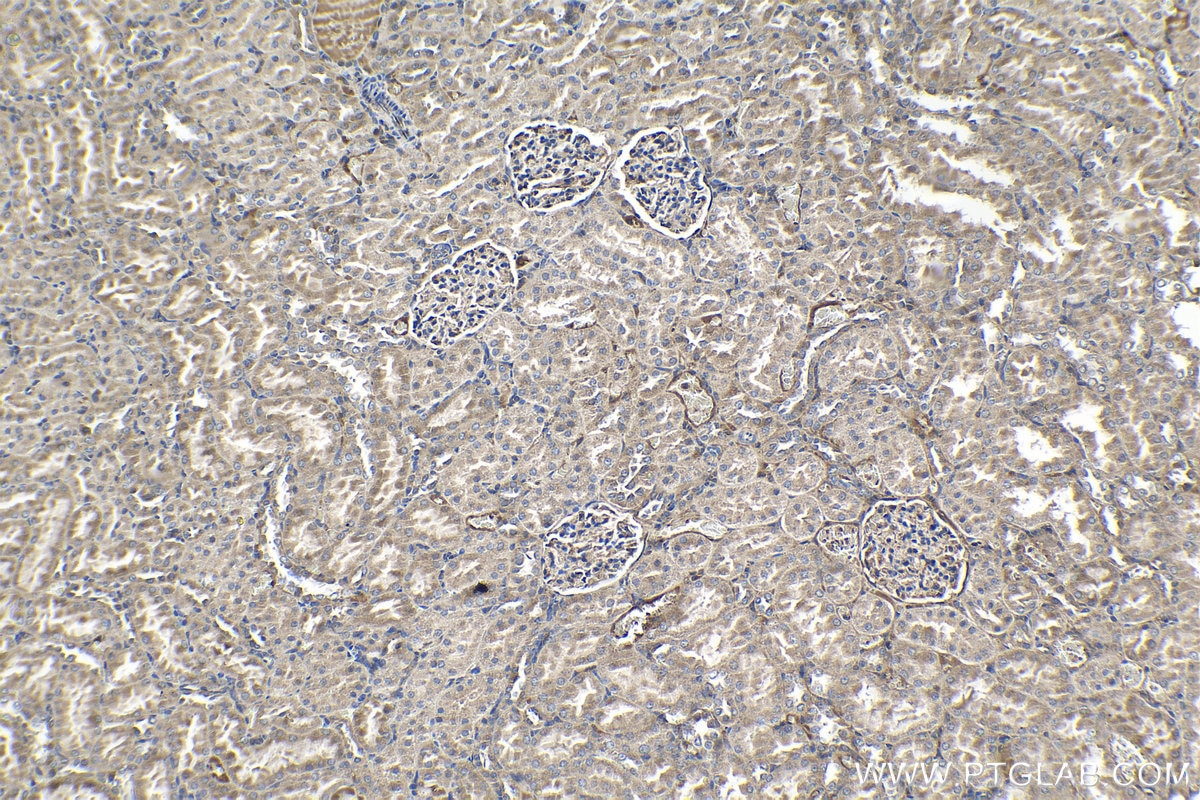 Immunohistochemical analysis of paraffin-embedded rat kidney tissue slide using KHC1379 (GLI2 IHC Kit).