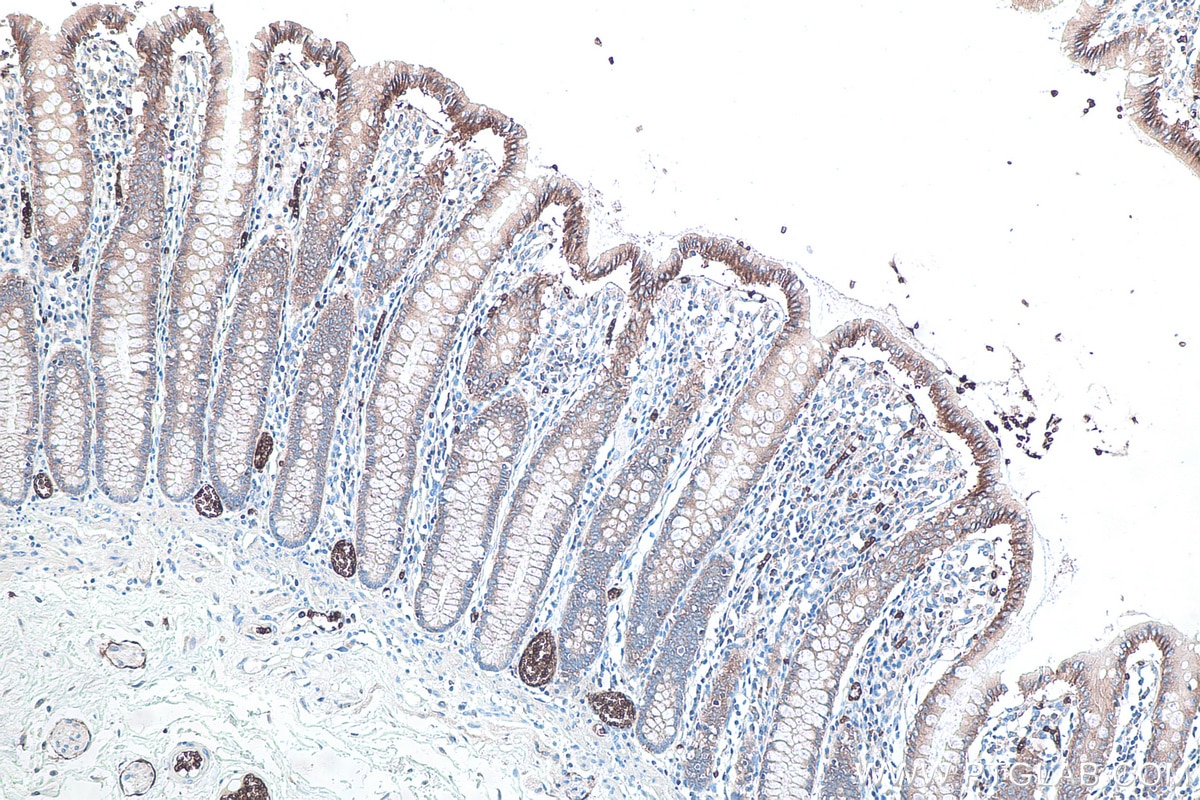 Immunohistochemical analysis of paraffin-embedded human colon tissue slide using KHC0036 (GLUT1 IHC Kit).