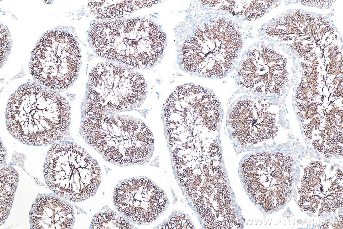 Immunohistochemical analysis of paraffin-embedded mouse testis tissue slide using KHC0090 (GLUT3 IHC Kit).