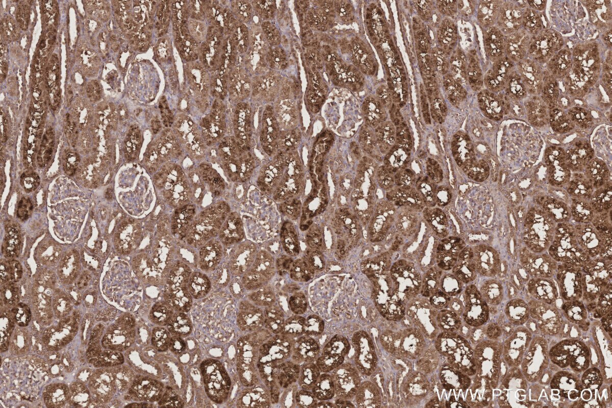 Immunohistochemical analysis of paraffin-embedded human kidney tissue slide using KHC3194 (GM2A IHC Kit).