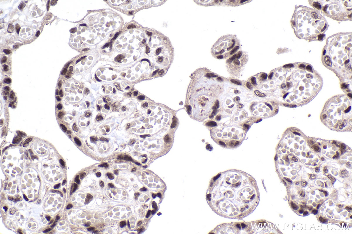 Immunohistochemical analysis of paraffin-embedded human placenta tissue slide using KHC1990 (GMEB2 IHC Kit).