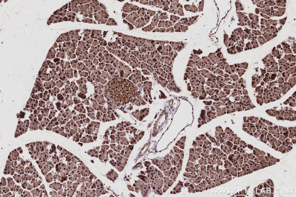 Immunohistochemical analysis of paraffin-embedded mouse pancreas tissue slide using KHC2988 (GMIP IHC Kit). Immunohistochemical analysis of paraffin-embedded mouse pancreas tissue slide using KHC2988 (GMIP IHC Kit).