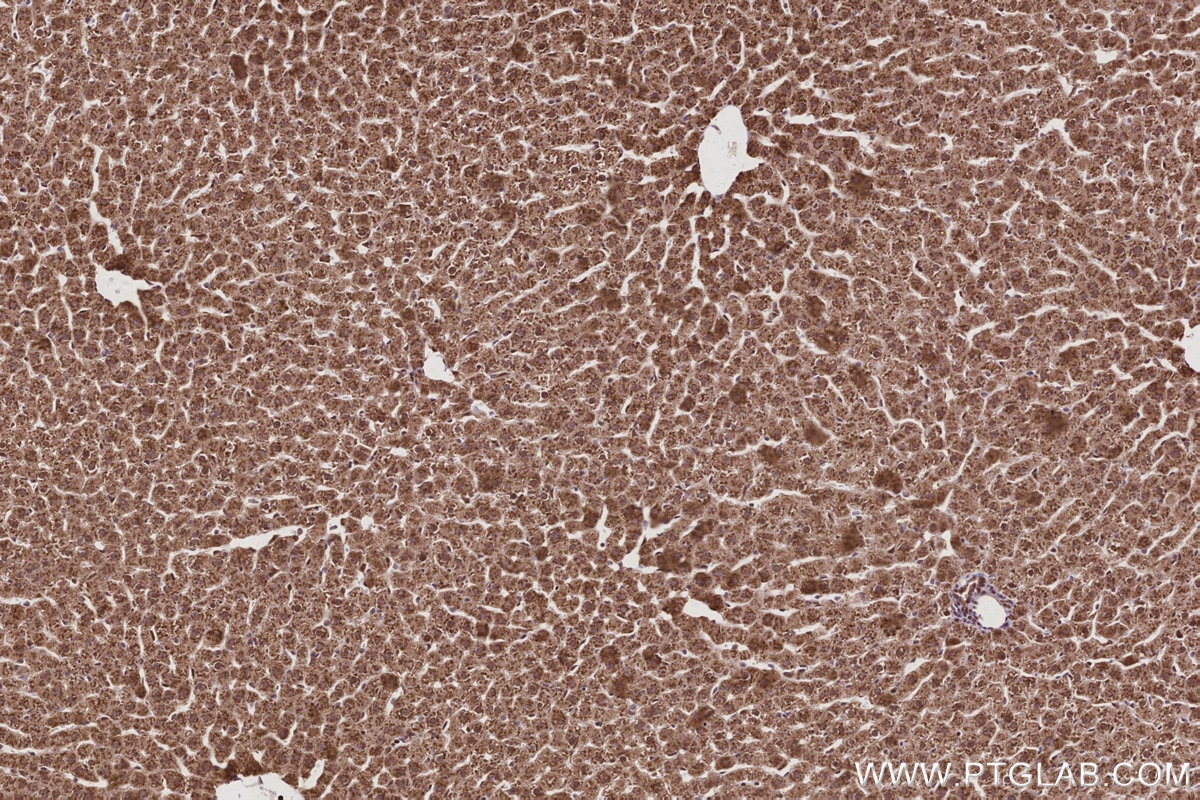 Immunohistochemical analysis of paraffin-embedded rat liver tissue slide using KHC2988 (GMIP IHC Kit). Immunohistochemical analysis of paraffin-embedded rat liver tissue slide using KHC2988 (GMIP IHC Kit).