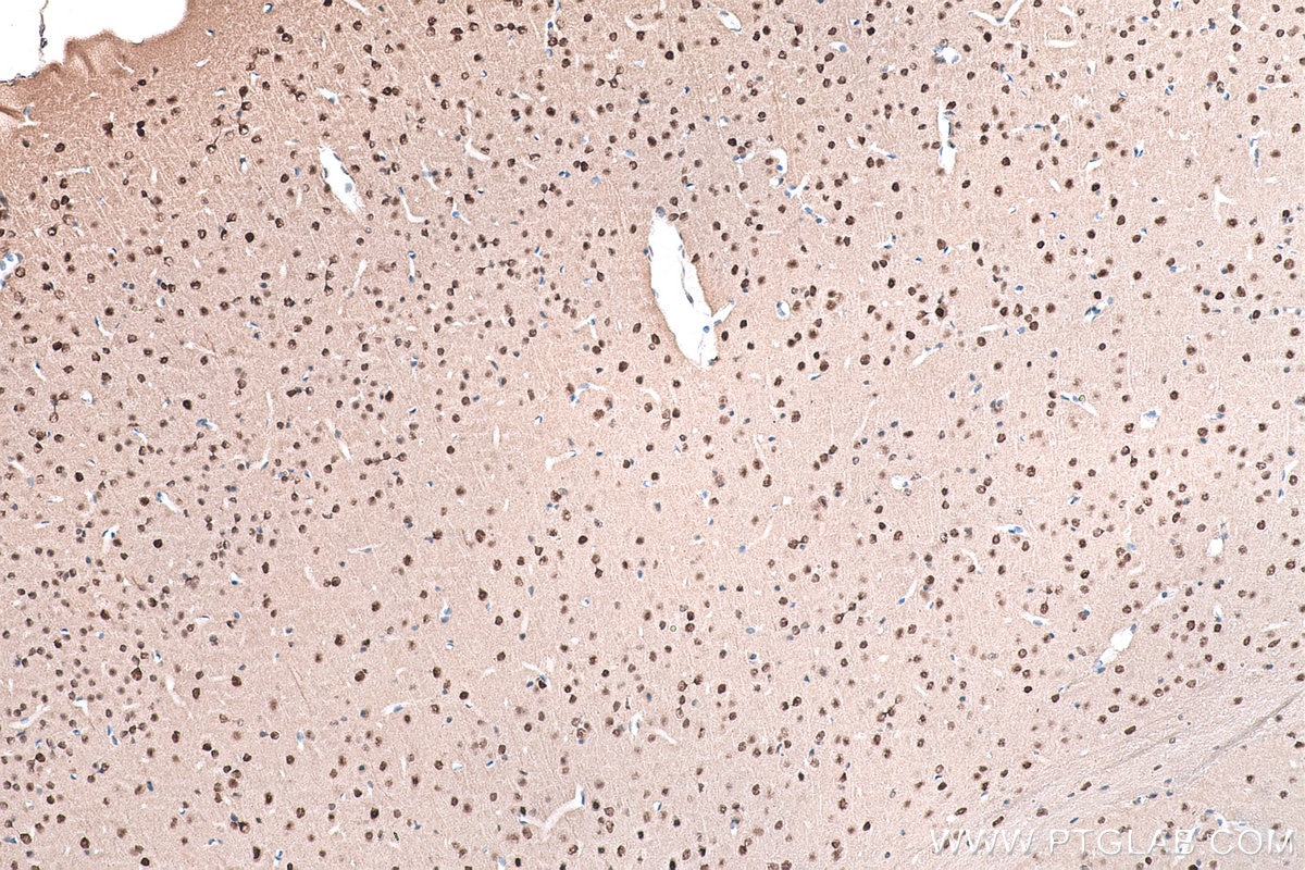 Immunohistochemical analysis of paraffin-embedded mouse brain tissue slide using KHC0890 (GMPS IHC Kit).