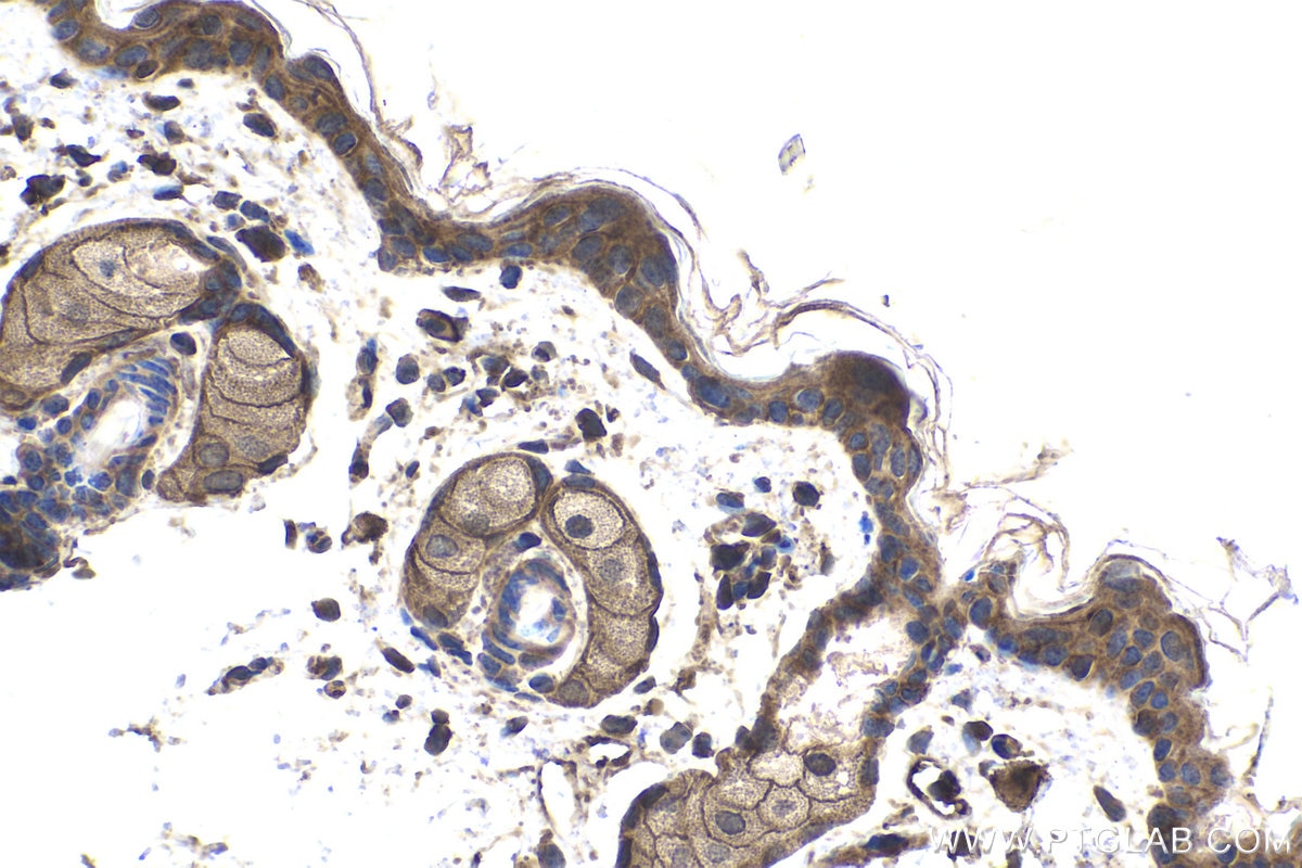 Immunohistochemical analysis of paraffin-embedded mouse skin tissue slide using KHC1730 (GNA13 IHC Kit).