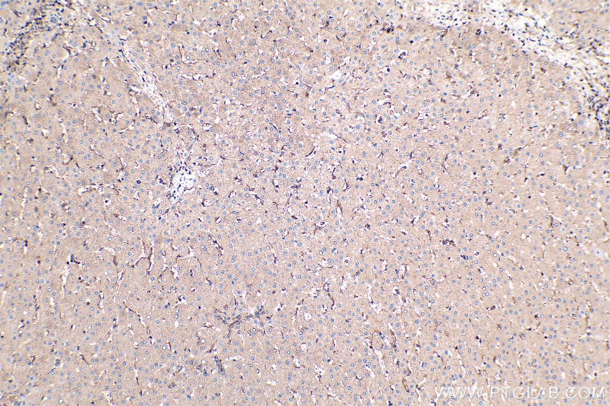 Immunohistochemical analysis of paraffin-embedded human liver tissue slide using KHC0423 (GNAI1 IHC Kit).