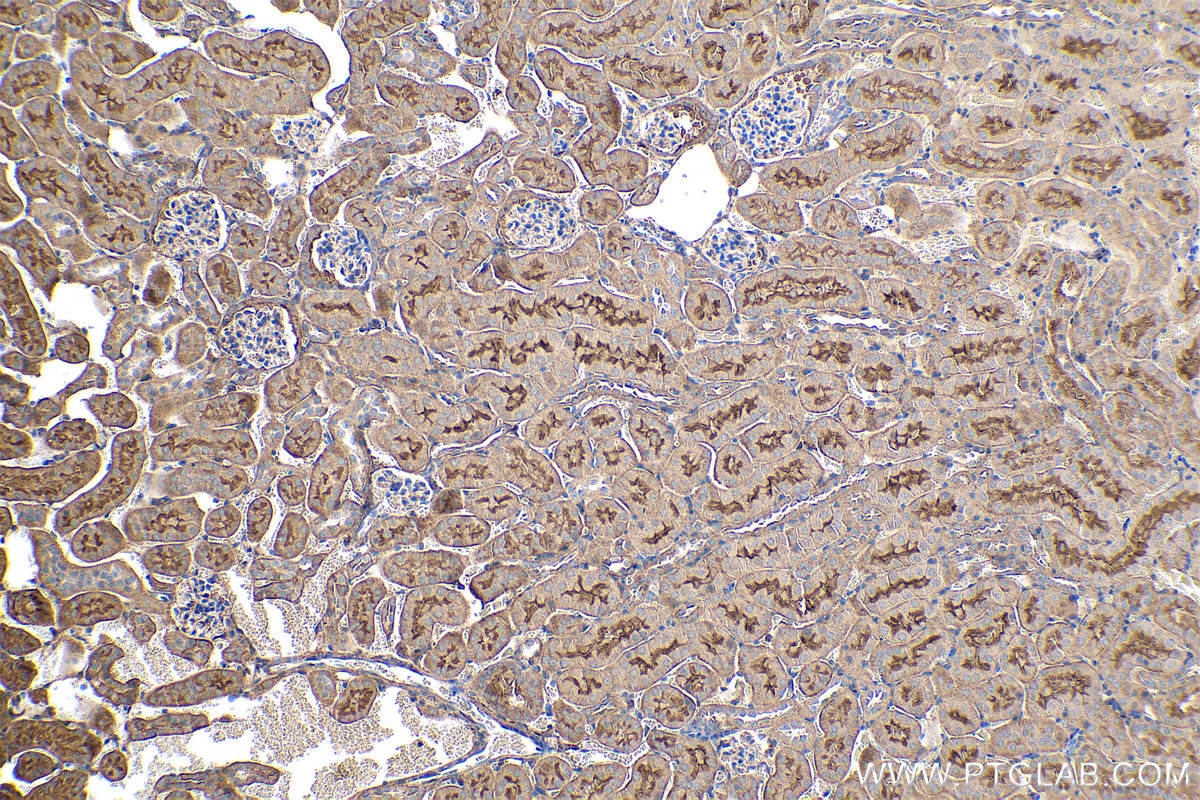 Immunohistochemical analysis of paraffin-embedded mouse kidney tissue slide using KHC0423 (GNAI1 IHC Kit).