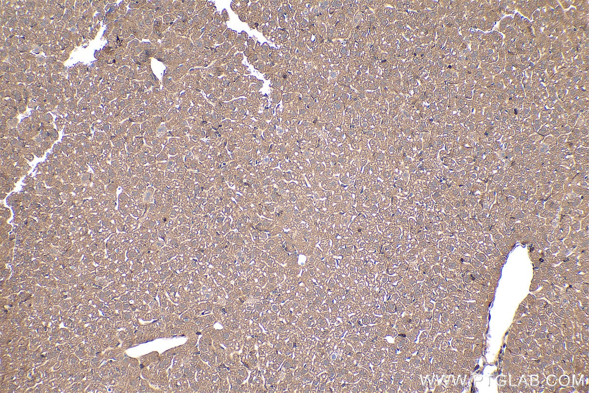 Immunohistochemical analysis of paraffin-embedded mouse liver tissue slide using KHC0423 (GNAI1 IHC Kit).