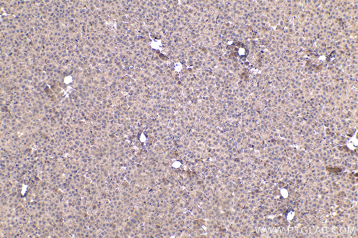 Immunohistochemical analysis of paraffin-embedded rat liver tissue slide using KHC0423 (GNAI1 IHC Kit).