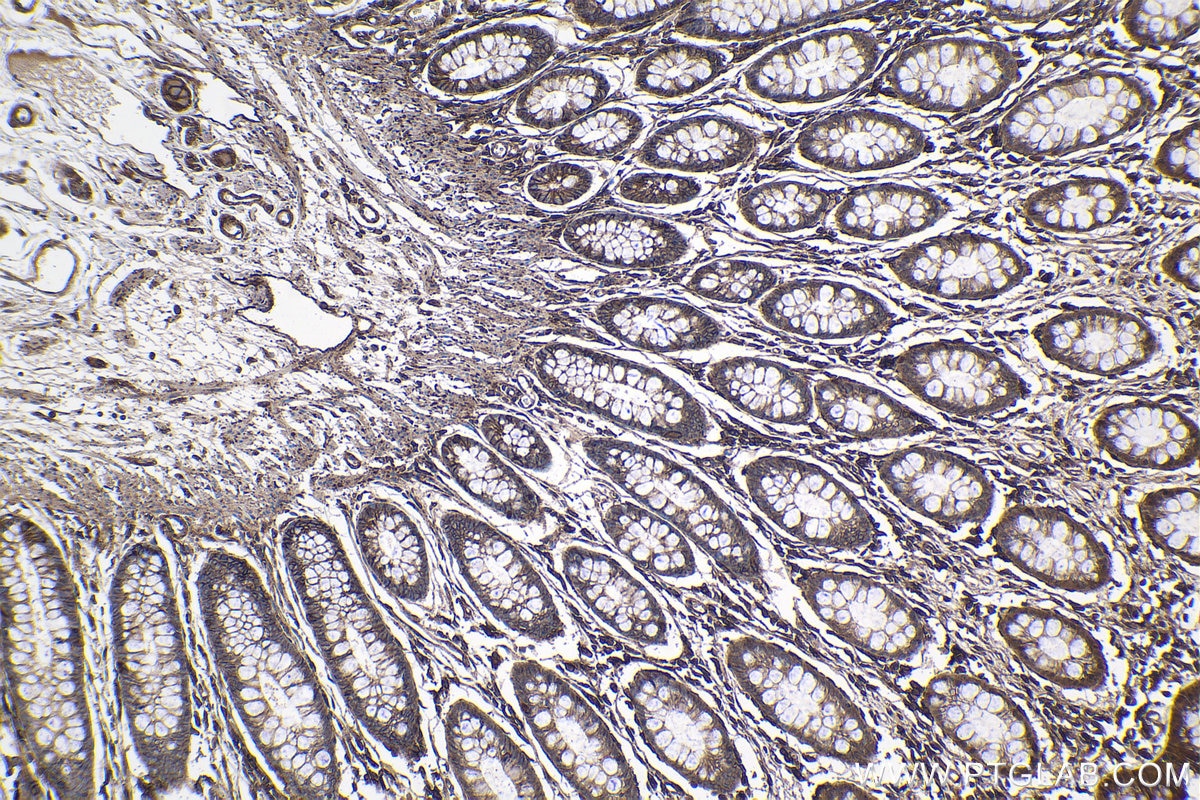 Immunohistochemical analysis of paraffin-embedded human colon tissue slide using KHC1076 (GNAS IHC Kit).