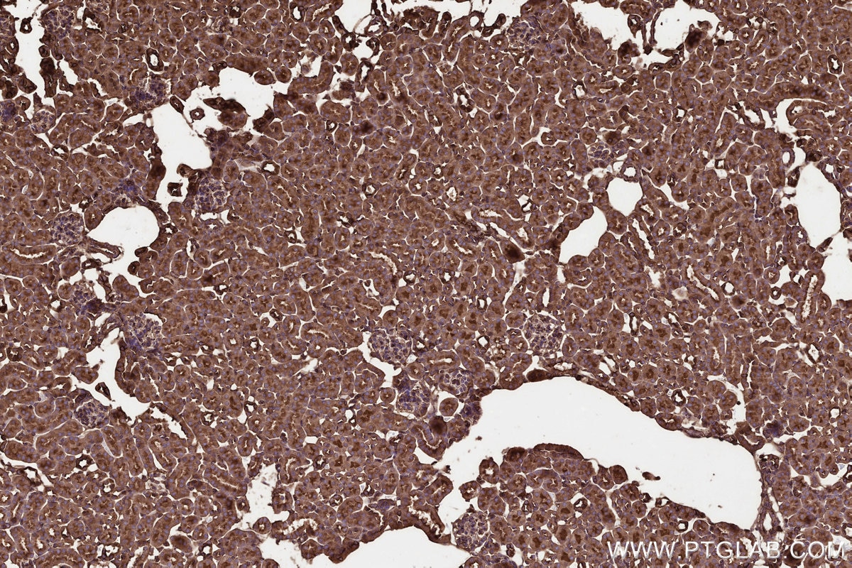 Immunohistochemical analysis of paraffin-embedded mouse kidney tissue slide using KHC3244 (GNB1 IHC Kit). Immunohistochemical analysis of paraffin-embedded mouse kidney tissue slide using KHC3244 (GNB1 IHC Kit).