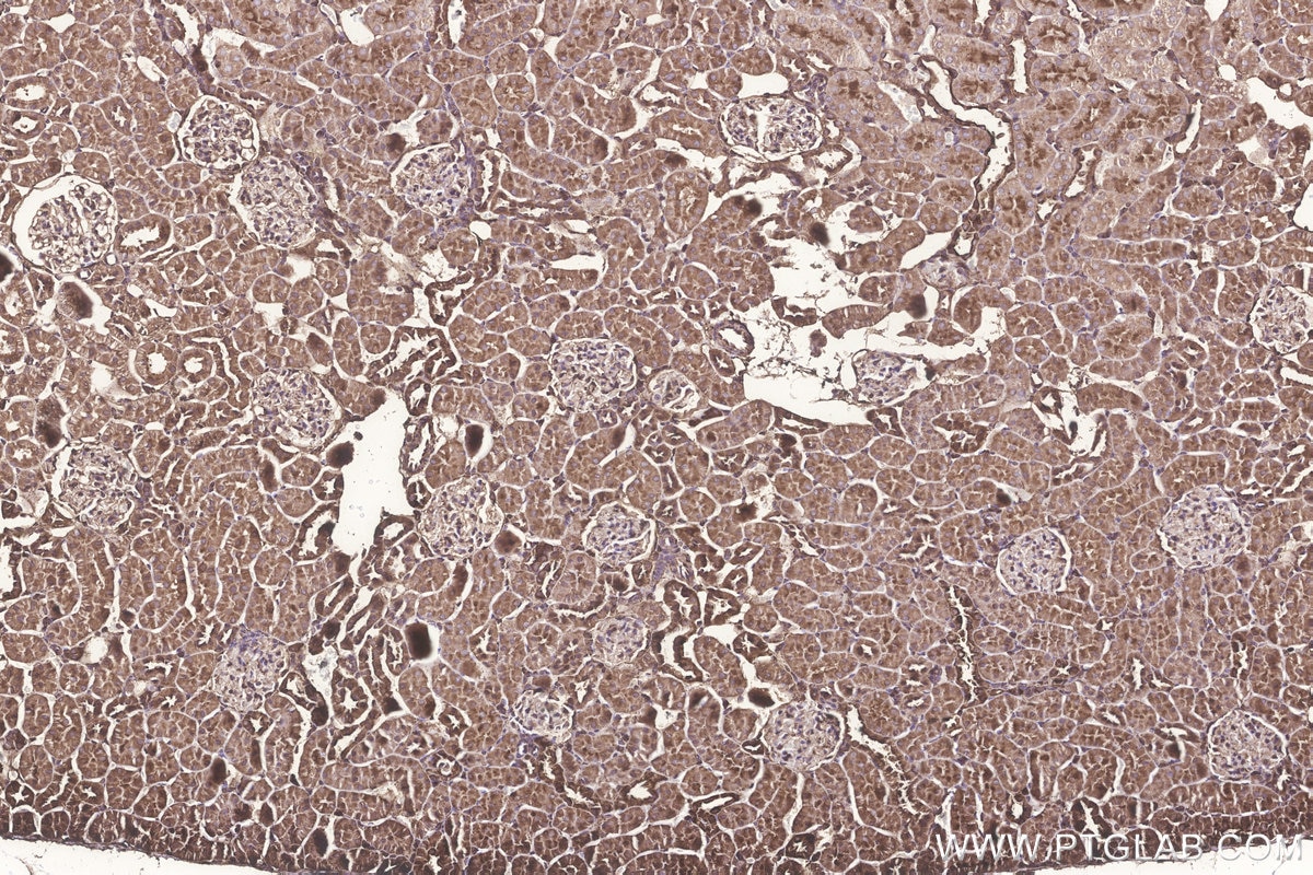 Immunohistochemical analysis of paraffin-embedded rat kidney tissue slide using KHC3244 (GNB1 IHC Kit). Immunohistochemical analysis of paraffin-embedded rat kidney tissue slide using KHC3244 (GNB1 IHC Kit).