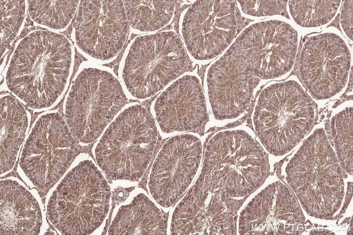 Immunohistochemical analysis of paraffin-embedded rat testis tissue slide using KHC3244 (GNB1 IHC Kit). Immunohistochemical analysis of paraffin-embedded rat testis tissue slide using KHC3244 (GNB1 IHC Kit).