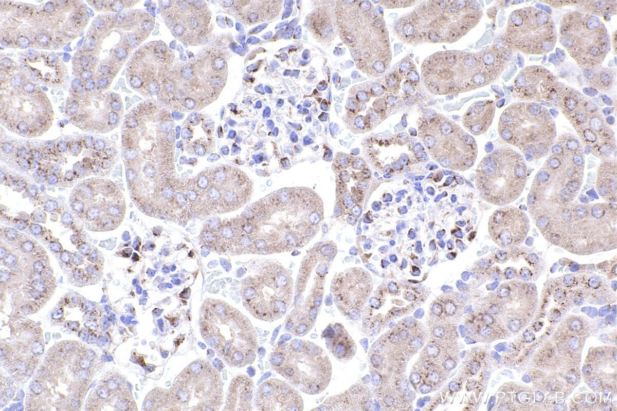 Immunohistochemical analysis of paraffin-embedded mouse kidney tissue slide using KHC2403 (GOLGA2/GM130 IHC Kit).