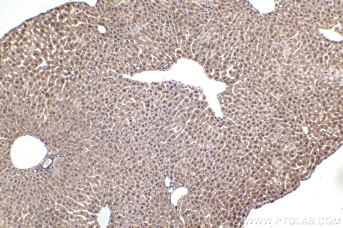 Immunohistochemical analysis of paraffin-embedded mouse liver tissue slide using KHC2402 (GOLGA3 IHC Kit).