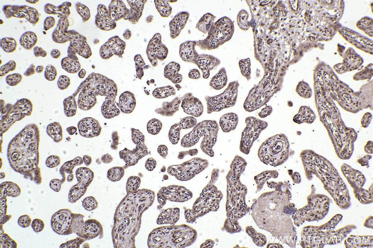 Immunohistochemical analysis of paraffin-embedded human placenta tissue slide using KHC2402 (GOLGA3 IHC Kit).