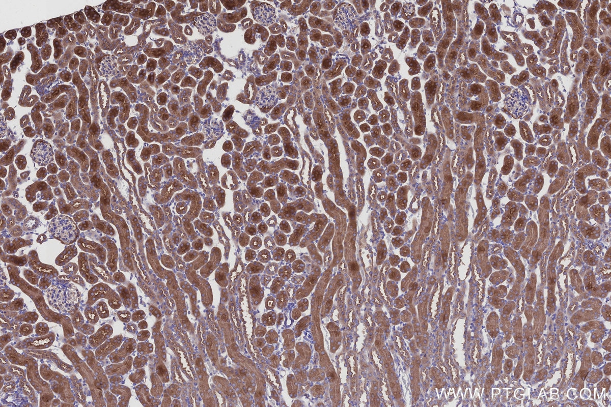 Immunohistochemical analysis of paraffin-embedded mouse kidney tissue slide using KHC2933 (GOPC IHC Kit).