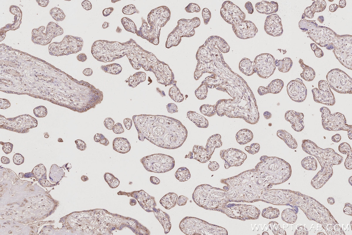 Immunohistochemical analysis of paraffin-embedded human placenta tissue slide using KHC2963 (GORASP1 IHC Kit).