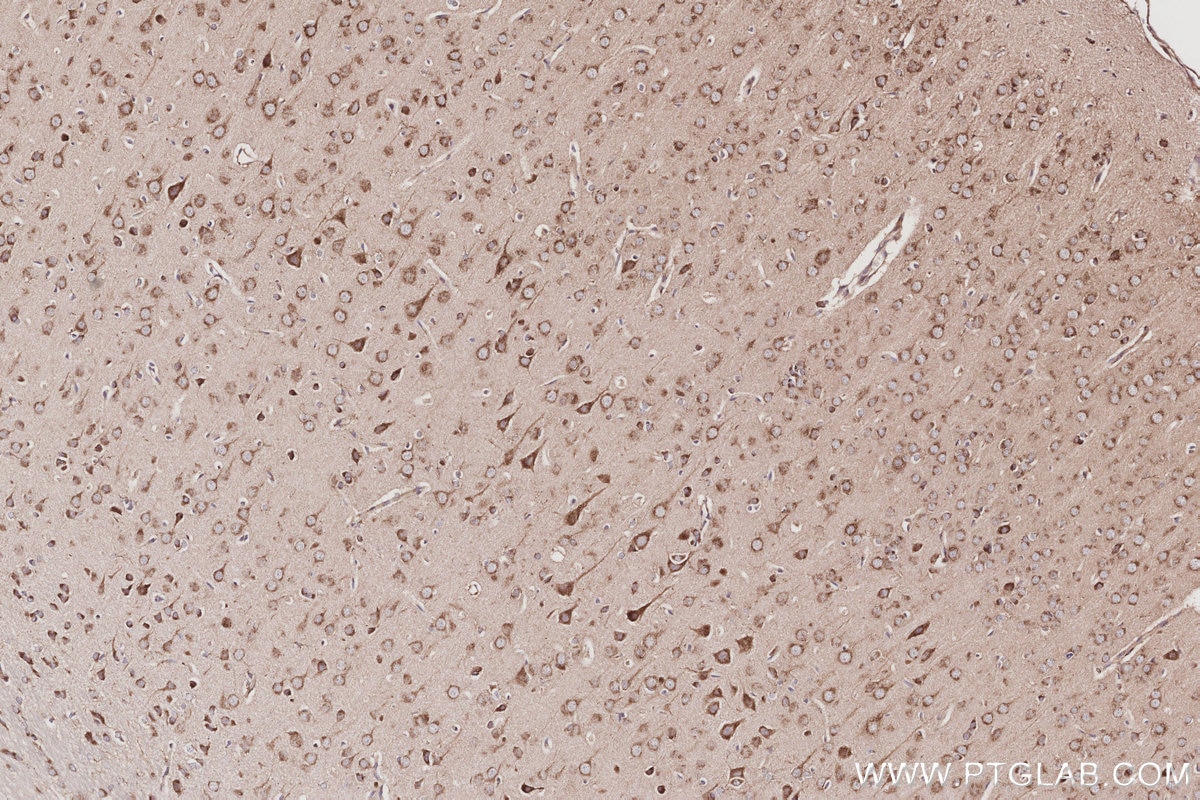 Immunohistochemical analysis of paraffin-embedded rat brain tissue slide using KHC2963 (GORASP1 IHC Kit).