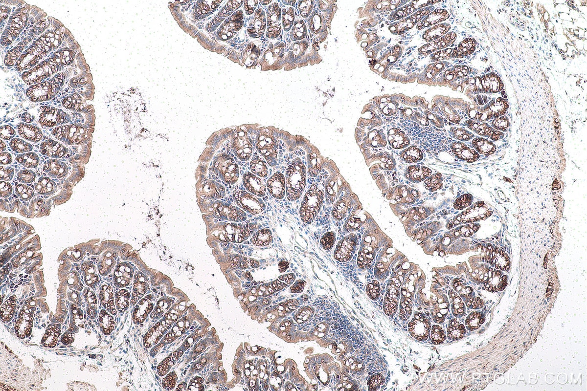 Immunohistochemical analysis of paraffin-embedded mouse colon tissue slide using KHC0947 (GORASP2 IHC Kit).