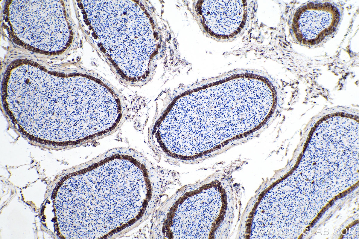 Immunohistochemical analysis of paraffin-embedded mouse epididymis tissue slide using KHC0947 (GORASP2 IHC Kit).