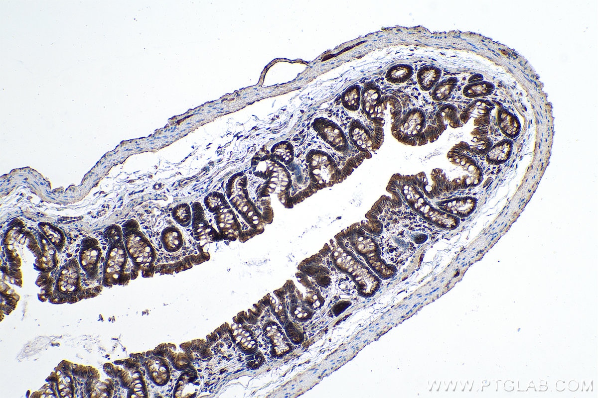 Immunohistochemical analysis of paraffin-embedded rat colon tissue slide using KHC0947 (GORASP2 IHC Kit).