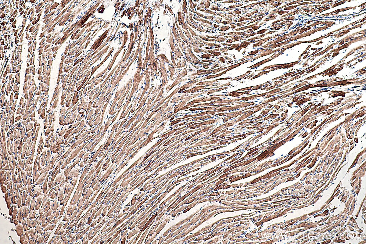 Immunohistochemical analysis of paraffin-embedded mouse heart tissue slide using KHC0320 (GOT2 IHC Kit).