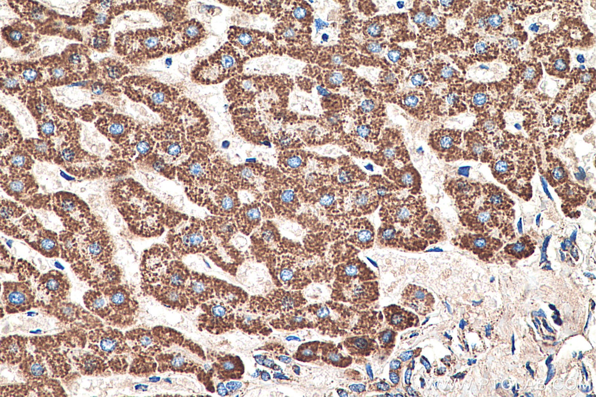 Immunohistochemical analysis of paraffin-embedded human liver tissue slide using KHC0320 (GOT2 IHC Kit).