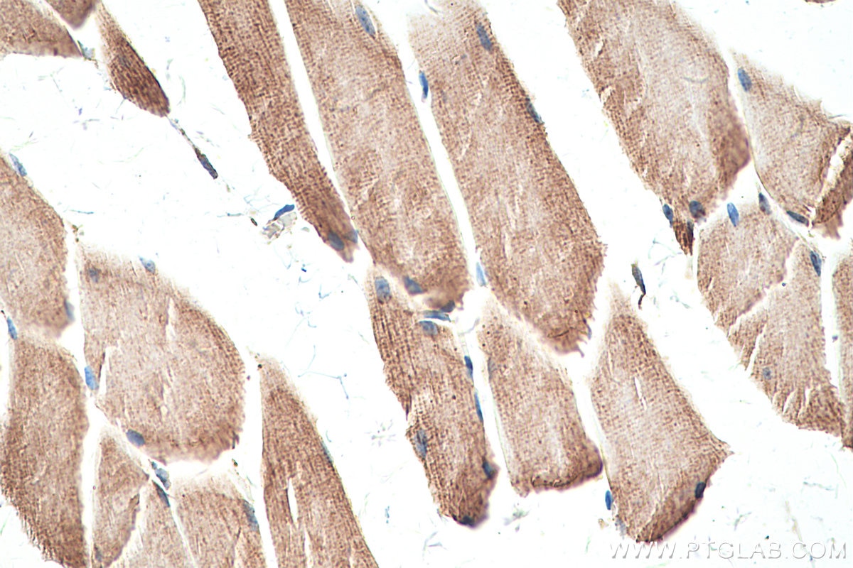 Immunohistochemical analysis of paraffin-embedded mouse skeletal muscle tissue slide using KHC0320 (GOT2 IHC Kit).
