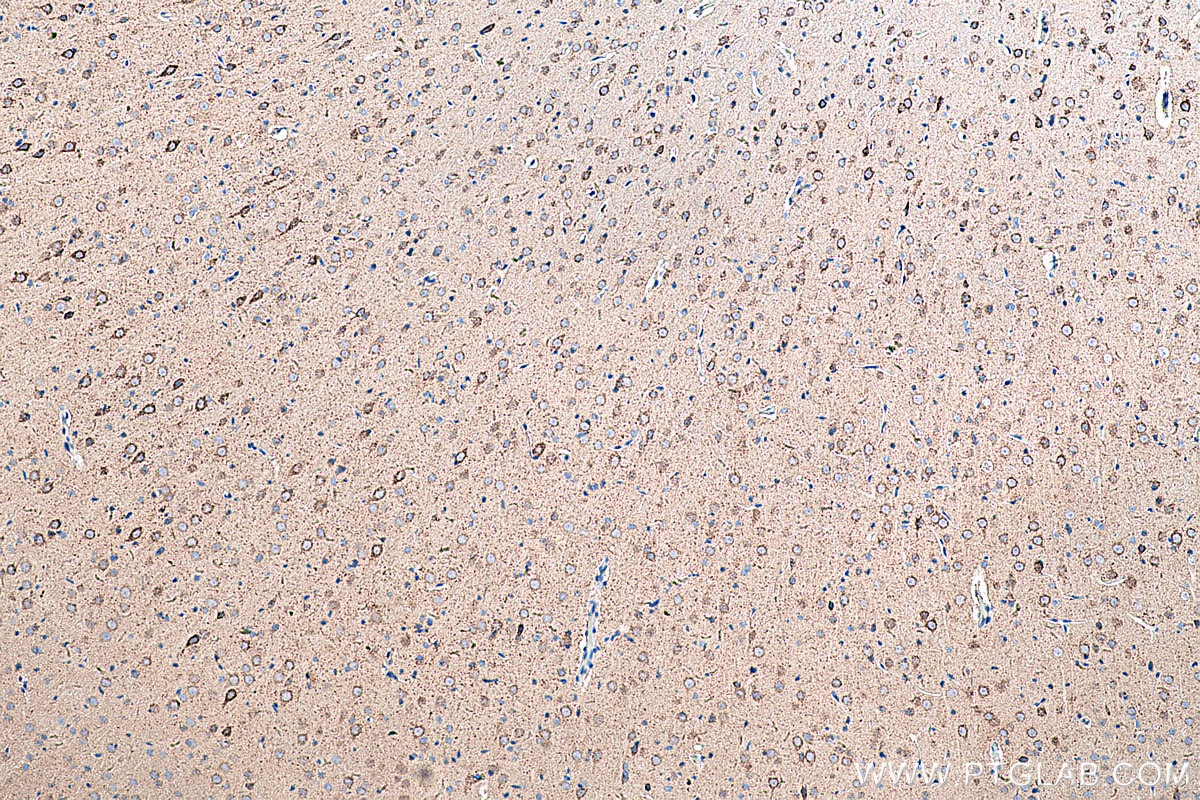 Immunohistochemical analysis of paraffin-embedded rat brain tissue slide using KHC0320 (GOT2 IHC Kit).