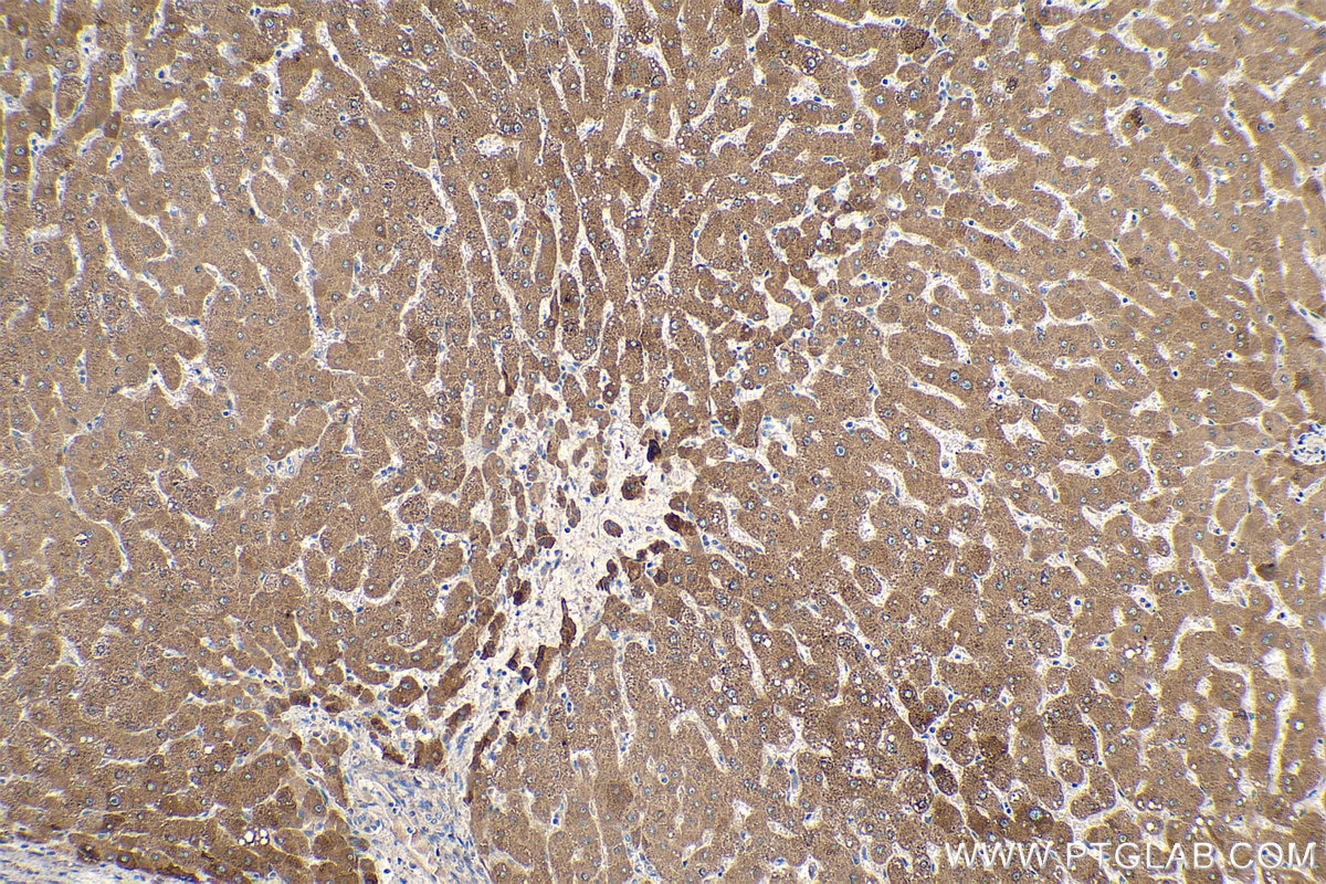 Immunohistochemical analysis of paraffin-embedded human liver tissue slide using KHC0235 (GPD1 IHC Kit).