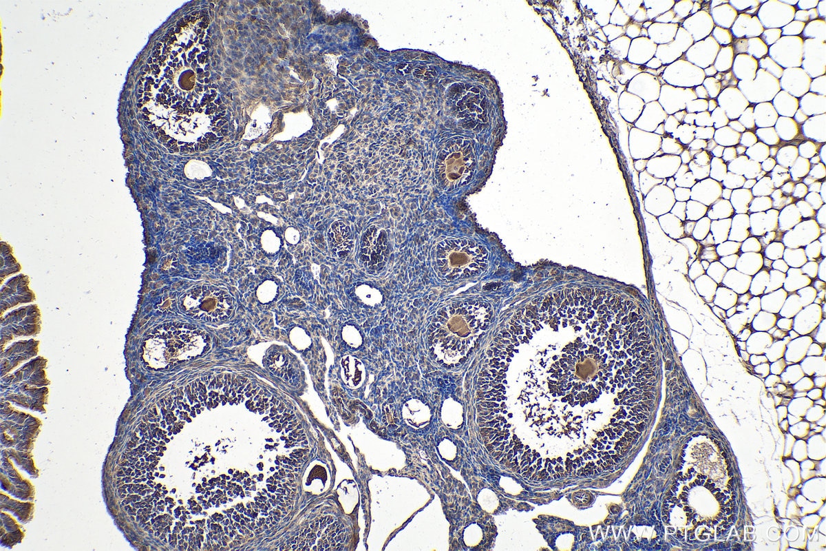 Immunohistochemical analysis of paraffin-embedded mouse ovary tissue slide using KHC0235 (GPD1 IHC Kit).