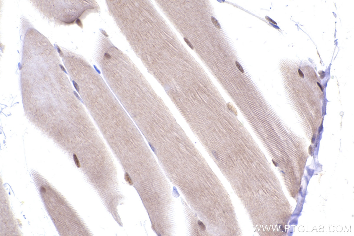 Immunohistochemical analysis of paraffin-embedded mouse skeletal muscle tissue slide using KHC2417 (GPS1/CSN1 IHC Kit).